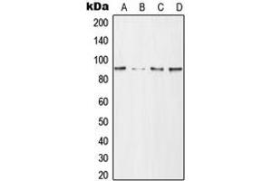Western blot analysis of CD168 expression in HeLa (A), NIH3T3 (B), mouse brain (C), H9C2 (D) whole cell lysates. (HMMR Antikörper  (Center))
