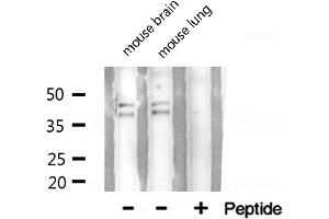 Western blot analysis of hnRNP A2/B1 expression in HepG2 cells (HNRNPA2B1 Antikörper  (N-Term))