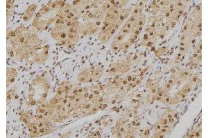 ABIN6273549 at 1/100 staining Human kidney tissue by IHC-P. (POGZ Antikörper  (Internal Region))