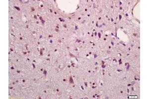 Formalin-fixed and paraffin embedded rat brain labeled with Anti-MAPKAPK5 Polyclonal Antibody, Unconjugated (ABIN754378) at 1:200 followed by conjugation to the secondary antibody and DAB staining (MAPKAP Kinase 5 Antikörper  (AA 89-190))