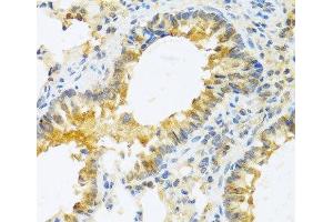 Immunohistochemistry of paraffin-embedded Mouse lung using IL20 Polyclonal Antibody at dilution of 1:100 (40x lens). (IL-20 Antikörper)