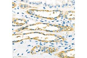 Immunohistochemistry of paraffin embedded human kidney using ATP1HC1 (ABIN7073160) at dilution of 1:500 (400x lens) (ATP12A Antikörper)