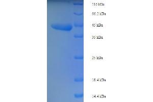 SDS-PAGE (SDS) image for RILP-Like Protein 1 (RIPL1) (AA 1-261), (full length) protein (His-SUMO Tag) (ABIN5710692) (RIPL1 Protein (AA 1-261, full length) (His-SUMO Tag))