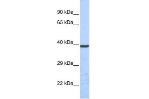 KCNK1 antibody used at 1 ug/ml to detect target protein.
