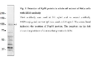 Western Blotting (WB) image for anti-Nucleoporin 98kDa (NUP98) (AA 1-466) antibody (ABIN2452066)