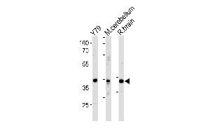 NeuroD1 Antibody  (ABIN388766 and ABIN2839060) western blot analysis in Y79 cell line ,mouse cerebellum and rat brain tissue lysates (35 μg/lane).