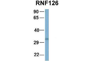 Host:  Rabbit  Target Name:  NOP56  Sample Type:  Human Fetal Brain  Antibody Dilution:  1. (RNF126 Antikörper  (N-Term))