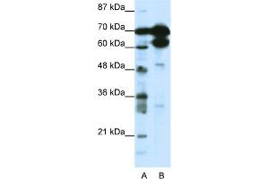 WB Suggested Anti-ZNF76 Antibody Titration:  1. (ZNF76 Antikörper  (N-Term))