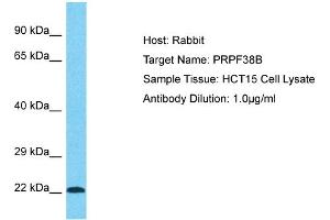 PRPF38B antibody  (Middle Region)