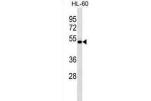 Western Blotting (WB) image for anti-N-Acylethanolamine Acid Amidase (NAAA) antibody (ABIN3000319) (NAAA Antikörper)