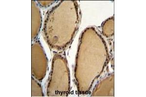 KLRAQ1 Antibody (Center) (ABIN655120 and ABIN2844751) immunohistochemistry analysis in formalin fixed and paraffin embedded human thyroid tissue followed by peroxidase conjugation of the secondary antibody and DAB staining. (KLRAQ1 Antikörper  (AA 207-236))