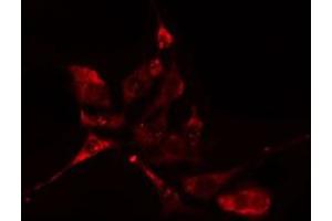 ABIN6276612 staining HuvEc cells by IF/ICC.