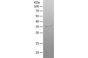 C18orf8 Protein (AA 1-305) (His tag)