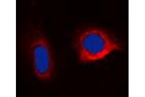 Immunofluorescent analysis of Caspase 6 staining in HepG2 cells. (Caspase 6 Antikörper  (C-Term))
