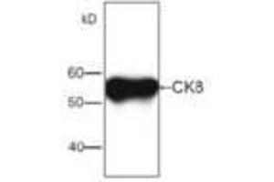 Image no. 1 for anti-Keratin 8 (KRT8) antibody (ABIN791532) (KRT8 Antikörper)