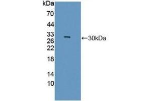 Detection of Recombinant GAMT, Rat using Polyclonal Antibody to Guanidinoacetate-N-Methyltransferase (GAMT) (GAMT Antikörper  (AA 2-236))