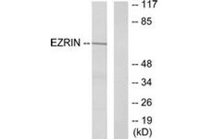 Western Blotting (WB) image for anti-Ezrin (EZR) (AA 321-370) antibody (ABIN2888987) (Ezrin Antikörper  (AA 321-370))