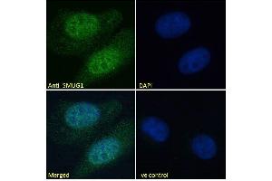 ABIN185204 Immunofluorescence analysis of paraformaldehyde fixed U2OS cells, permeabilized with 0. (SMUG1 Antikörper  (N-Term))
