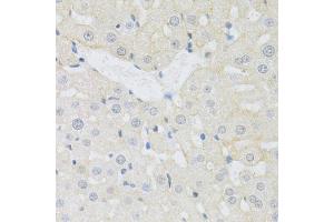 Immunohistochemistry of paraffin-embedded rat liver using SLC3A2 antibody (ABIN1876903) at dilution of 1:100 (40x lens). (SLC3A2 Antikörper)