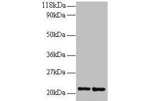 Western blot All lanes: RPS9 antibody at 2 μg/mL Lane 1: 293T whole cell lysate Lane 2: EC109 whole cell lysate Secondary Goat polyclonal to rabbit IgG at 1/15000 dilution Predicted band size: 21 kDa Observed band size: 21 kDa (RPS9 Antikörper  (AA 2-184))