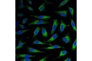Immunofluorescent analysis of COX4-1 staining in Hela cells.