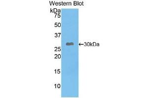 Western Blotting (WB) image for anti-Leptin Receptor (LEPR) (AA 310-539) antibody (ABIN3209411) (Leptin Receptor Antikörper  (AA 310-539))