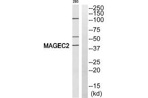 Western blot analysis of extracts from 293 cells, using MAGEC2 antibody. (MAGEC2 Antikörper  (Internal Region))