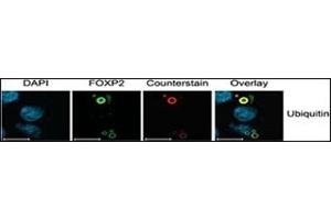Image no. 1 for anti-Ubiquitin (Ub) (AA 44-73), (C-Term) antibody (ABIN356747)