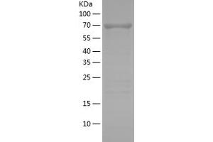 Western Blotting (WB) image for Mitogen-Activated Protein Kinase 1 (MAPK1) (AA 1-360) protein (His-IF2DI Tag) (ABIN7123989) (ERK2 Protein (AA 1-360) (His-IF2DI Tag))