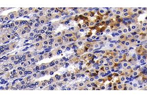 Detection of NFKB3 in Rat Stomach Tissue using Polyclonal Antibody to Transcription Factor P65 (NFKB3)