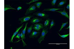 Immunofluorescence of purified MaxPab antibody to LAMB1 on HeLa cell.