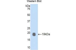 Western blot analysis of the recombinant protein. (GDF1 Antikörper  (AA 230-357))