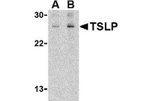 Western Blotting (WB) image for anti-Thymic Stromal Lymphopoietin (TSLP) (C-Term) antibody (ABIN1030782)