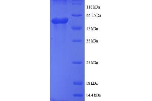 SDS-PAGE (SDS) image for Casein Kinase 1, epsilon (CSNK1E) (AA 17-231) protein (GST tag) (ABIN5712131)