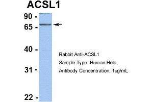 Human Hela (ACSL1 Antikörper  (C-Term))