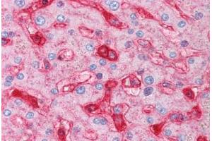 Human Liver (formalin-fixed, paraffin-embedded) stained with B2M antibody ABIN334257 at 5 ug/ml followed by biotinylated anti-mouse IgG secondary antibody ABIN481714, alkaline phosphatase-streptavidin and chromogen. (beta-2 Microglobulin Antikörper)