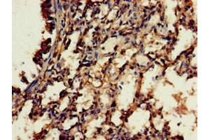 Immunohistochemistry of paraffin-embedded human lung tissue using ABIN7166771 at dilution of 1:100 (RBFA Antikörper  (AA 201-343))