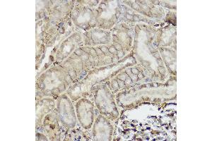 Immunohistochemistry of paraffin-embedded mouse kidney using P Glycoprotein Rabbit pAb (ABIN6134229, ABIN6136340, ABIN6136343 and ABIN6215453) at dilution of 1:250 (40x lens). (ABCB1 Antikörper  (AA 600-700))