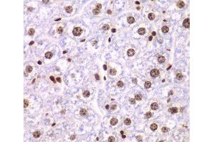 Immunohistochemistry of paraffin-embedded Mouse liver using SSRP1 Polyclonal Antibody at dilution of 1:200 (40x lens). (SSRP1 Antikörper)