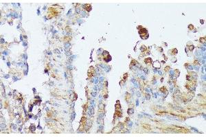 Immunohistochemistry of paraffin-embedded Mouse lung using WNT1 Polyclonal Antibody at dilution of 1:100 (40x lens). (WNT1 Antikörper)