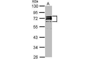 Western Blot: Lamin A/C antibody staining of HeLa Nucleus (A) (20 µg) at 1/3000 dilution, 10% SDS PAGE. (Lamin A/C Antikörper  (AA 59-249))