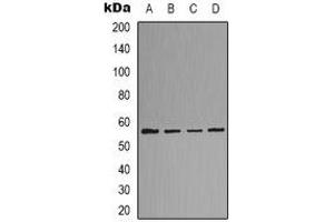 Western blot analysis of LCK expression in Hela (A), Jurkat (B), mouse kidney (C), rat liver (D) whole cell lysates. (LCK Antikörper)