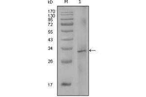 Western Blot showing F8 antibody used against truncated Trx-F8 recombinant protein (1).