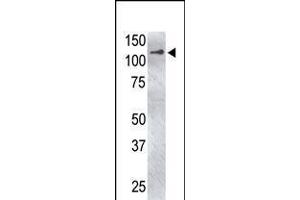 Antibody is used in Western blot to detect USP4 in USP4-transfected HeLa cell lysate. (USP4 Antikörper  (C-Term))