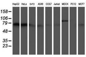 Image no. 2 for anti-5-Aminoimidazole-4-Carboxamide Ribonucleotide Formyltransferase/IMP Cyclohydrolase (ATIC) antibody (ABIN1496504) (ATIC Antikörper)