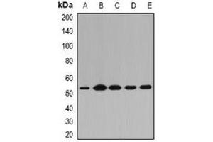 Western blot analysis of PGD expression in A549 (A), Raji (B), mouse lung (C), mouse spleen (D), rat kidney (E) whole cell lysates.