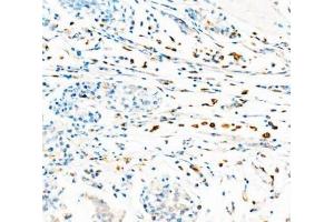 IHC analysis of CD68 using anti-CD68 antibody (ABIN7600142). (CD68 Antikörper  (AA 154-354))
