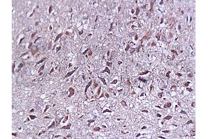 Formalin-fixed and paraffin embedded rat brain tissue labeled with Anti-SYP p38/Synaptophysin/SAP-1 Polyclonal Antibody, Unconjugated (ABIN725285) at 1:200, followed by conjugation to the secondary antibody and DAB staining (SYAP1 Antikörper  (AA 151-230))
