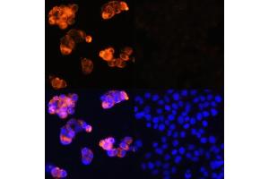 Immunofluorescence analysis of HepG2 cells (upper left) and LO2 cells (negative sample control) (upper right) using Alpha-Fetoprotein (Alpha-Fetoprotein (AFP)) Rabbit pAb (red, ABIN6129175, ABIN6136616, ABIN6136618 and ABIN6215038) at dilution of 1:100. (alpha Fetoprotein Antikörper  (AA 360-609))