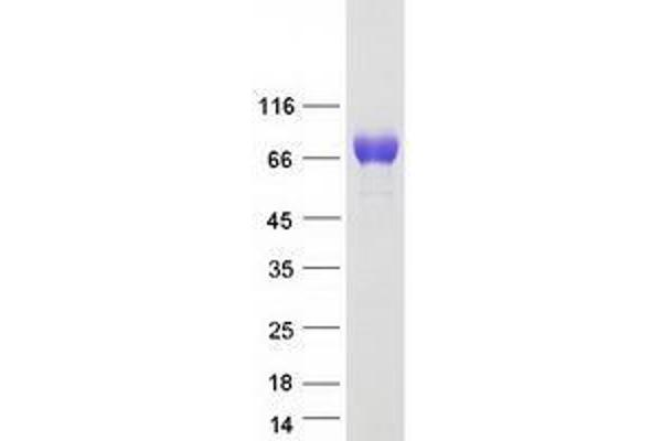 Tyrosinase-Related Protein 1 Protein (TYRP1) (Myc-DYKDDDDK Tag)